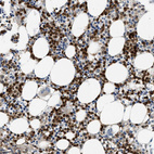 Anti-ANXA3 Antibody