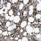 Immunohistochemical staining of human bone marrow shows strong cytoplasmic positivity in hematopoietic cells.