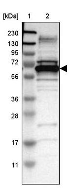 Lane 1: Marker [kDa] 230, 130, 95, 72, 56, 36, 28, 17, 11_br/_Lane 2: Human cell line RT-4