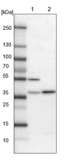 Lane 1: Mouse liver tissue lysate_br/_Lane 2: Rat liver tissue lysate