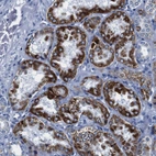 Anti-SNX19 Antibody