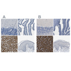 Immunohistochemical staining of human cerebellum, fallopian tube, liver and skin using Anti-CYP2C8 antibody HPA013547 (A) shows similar protein distribution across tissues to independent antibody HPA013970 (B).