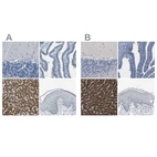 Immunohistochemical staining of human cerebellum, fallopian tube, liver and skin using Anti-CYP2C8 antibody HPA013547 (A) shows similar protein distribution across tissues to independent antibody HPA013970 (B).