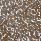 Immunohistochemical staining of human liver shows strong cytoplasmic positivity in hepatocytes.