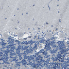 Immunohistochemical staining of human cerebellum shows no positivity in Purkinje cells as expected.