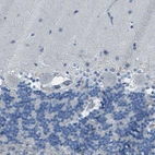 Immunohistochemical staining of human cerebellum shows no positivity in Purkinje cells as expected.