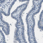 Immunohistochemical staining of human Fallopian tube shows no positivity in glandular cells as expected.