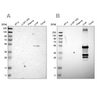 Western blot analysis using Anti-CYP2C8 antibody HPA013547 (A) shows similar pattern to independent antibody HPA013970 (B).