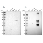 Western blot analysis using Anti-CYP2C8 antibody HPA013547 (A) shows similar pattern to independent antibody HPA013970 (B).