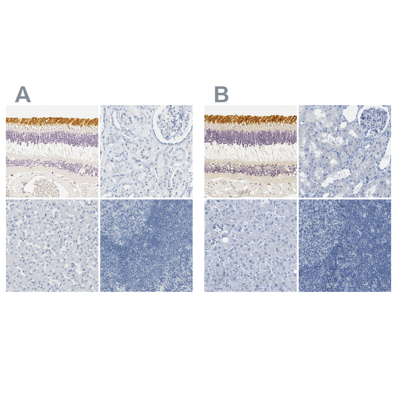 Anti-OPN1SW Antibody