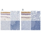 Anti-OPN1SW Antibody