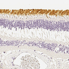 Immunohistochemical staining of human eye, retina using Anti-OPN1SW antibody HPA013562.
