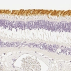 Immunohistochemical staining of human eye, retina using Anti-OPN1SW antibody HPA013562.