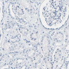 Immunohistochemical staining of human kidney shows no positivity in cells in tubules as expected.