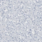 Immunohistochemical staining of human liver shows no positivity in hepatocytes as expected.
