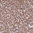 Anti-TYW1B Antibody
