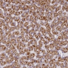 Anti-TYW1B Antibody
