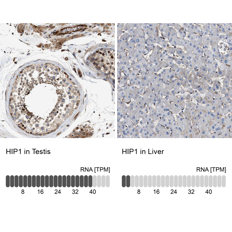 Anti-HIP1 Antibody
