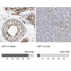 Anti-HIP1 Antibody