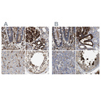 Immunohistochemical staining of human colon, kidney, liver and testis using Anti-HIP1 antibody HPA013606 (A) shows similar protein distribution across tissues to independent antibody HPA017964 (B).