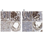 Immunohistochemical staining of human colon, kidney, liver and testis using Anti-HIP1 antibody HPA013606 (A) shows similar protein distribution across tissues to independent antibody HPA017964 (B).