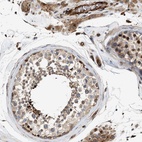 Immunohistochemical staining of human testis shows high expression.