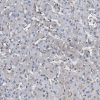 Immunohistochemical staining of human liver shows low expression as expected.