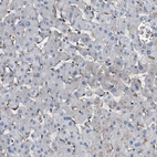 Immunohistochemical staining of human liver shows low expression as expected.