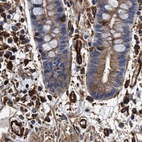 Immunohistochemical staining of human colon using Anti-HIP1 antibody HPA013606.