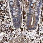 Immunohistochemical staining of human colon using Anti-HIP1 antibody HPA013606.