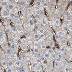 Immunohistochemical staining of human liver using Anti-HIP1 antibody HPA013606.