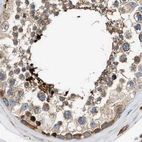 Immunohistochemical staining of human testis using Anti-HIP1 antibody HPA013606.