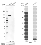 Western blot analysis in human cell lines A-549 and Caco-2 using Anti-HIP1 antibody. Corresponding HIP1 RNA-seq data are presented for the same cell lines. Loading control: Anti-PPIB.