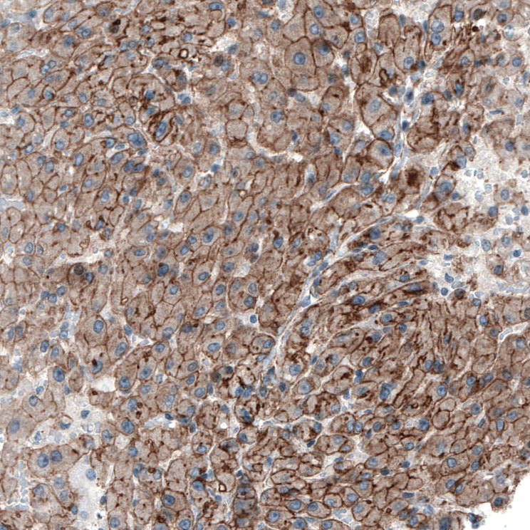 Anti-MYO1B Antibody