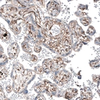 Immunohistochemical staining of human placenta shows moderate membranous positivity in trophoblastic cells.