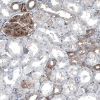 Immunohistochemical staining of human kidney shows moderate membranous positivity in cells in glomeruli and in cells in tubules.