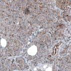 Immunohistochemical staining of human pancreas shows moderate membranous positivity in exocrine glandular cells.