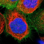 Immunofluorescent staining of human cell line A-431 shows localization to plasma membrane.