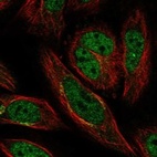 Immunofluorescent staining of human cell line SiHa shows localization to nucleoplasm & the Golgi apparatus.