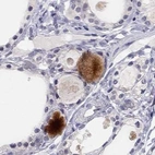 Immunohistochemical staining of human thyroid gland using Anti-C16orf89 antibody HPA013613.