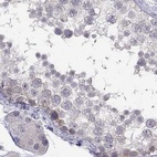 Immunohistochemical staining of human testis using Anti-C16orf89 antibody HPA013613.