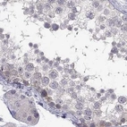 Immunohistochemical staining of human testis using Anti-C16orf89 antibody HPA013613.