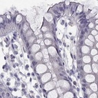Immunohistochemical staining of human colon using Anti-C16orf89 antibody HPA013613.