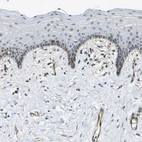 Anti-ECE1 Antibody