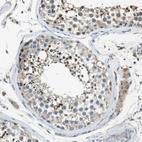 Immunohistochemical staining of human testis shows moderate to strong cytoplasmic positivity in cells in seminiferous ducts.