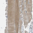 Immunohistochemical staining of human skeletal muscle shows weak to moderate cytoplasmic positivity in myocytes.
