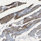 Anti-NCMAP Antibody