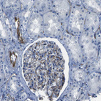 Anti-HSPA12B Antibody