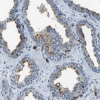 Immunohistochemical staining of human prostate shows moderate cytoplasmic positivity in glandular cells.