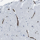 Immunohistochemical staining of human cerebral cortex shows strong positivity in endothelial cells.